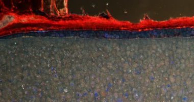 Darkfield dokusunda badem mikroskop altında 100x