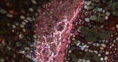 Mikroskop altında Darkfield dokusunda sahte turuncu çalı kökü.