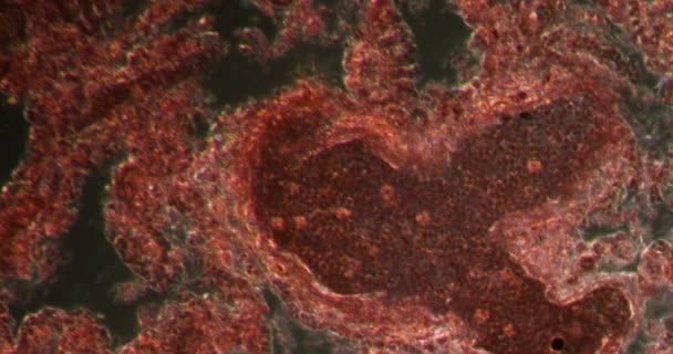 Жирна Емболія Тканинах Darkfield Під Мікроскопом 200X — стокове відео