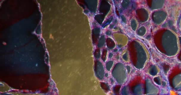 Coloide Strumă Țesutul Darkfield Sub Microscop 100X — Videoclip de stoc