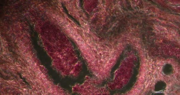 Amigdalită Țesutul Darkfield Sub Microscop 200X — Videoclip de stoc