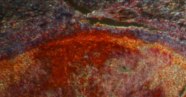 Esofag Inflamație Țesutul Darkfield Sub Microscop 200X — Videoclip de stoc