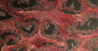Darkfield dokusundaki Inguinal testisler mikroskop altında 100 x