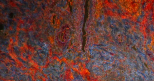 Inflamação Intestino Grosso Tecido Darkfield Sob Microscópio 100X — Vídeo de Stock