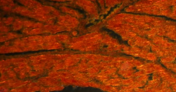 Ovarian Kista Dalam Jaringan Darkfield Bawah Mikroskop 200X — Stok Video