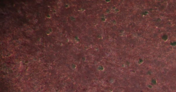Gliom Εγκέφαλος Στο Darkfield Ιστό Κάτω Από Μικροσκόπιο 200X — Αρχείο Βίντεο
