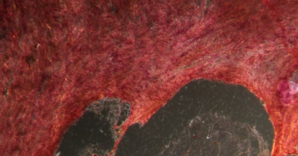 Gelatinous Cancer Rectum Darkfield Tissue Microscope 100X — Stock Video