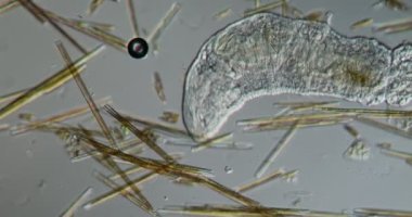 Deri solucanı derede 100 kat daha fazla yiyecek arıyor.