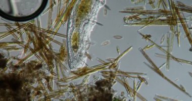 Deri solucanı derede 100 kat daha fazla yiyecek arıyor.