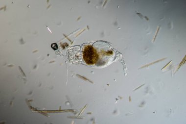 Rotifer derede 100 kat daha fazla yiyecek arıyor.