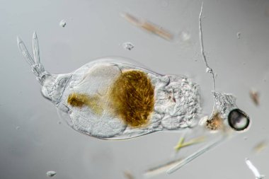 Rotifer 200 x deresinde yiyecek arıyor.