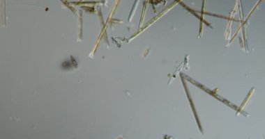 Nehirden gelen çeşitli diatomlar