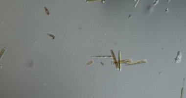 Nehirden gelen çeşitli diatomlar