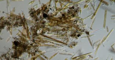 Nehirden gelen çeşitli diatomlar