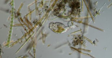 Rotifer derede 100 kat daha fazla yiyecek arıyor.