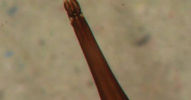 Büyüteçin altındaki frenlerin ağızlarını emen delici bir kafası var.