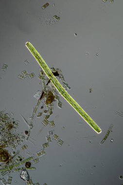Green algae under the microscope 100x