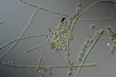 Green algae under the microscope 100x