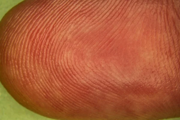 Fingertip Papillary Lines Skin — Stock Fotó