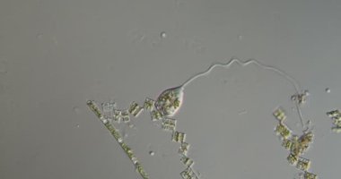 Vorticela derede yiyecek arıyor. 100 kat daha fazla.