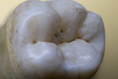 Diş kökleriyle kaplanmış insan azı dişleri.