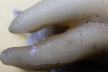 Diş kökleriyle kaplanmış insan azı dişleri.