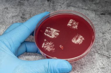 Bilim adamı, yakın çekim için parmak izlerinden bakteri içeren bir petri diski tutuyor.