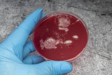 Bilim adamı, yakın çekim için bağırsak bakterilerinin bakterilerini içeren bir petri diski tutuyor.