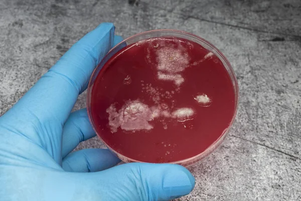 Bilim adamı, yakın çekim için bağırsak bakterilerinin bakterilerini içeren bir petri diski tutuyor.