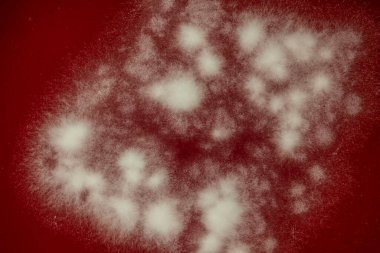 Bilim adamı, yakın çekim için parmak izlerinden bakteri içeren bir petri diski tutuyor.