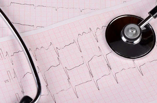 The tape with the cardiogram of a man — Stock Photo, Image