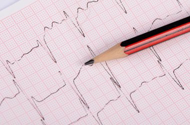 bir adamın kardiyogram bandıyla