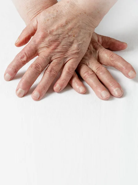 Aging Hands Old Year Old Woman Age Spots Deep Wrinkles — Stock Photo, Image