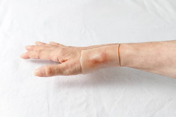 Special Medical Self Adhesive Silicone Gel Sheet Healing Scar Tendon — Stock Photo, Image