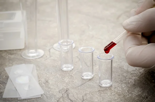 Тестові трубки з кров'ю в лабораторії — стокове фото