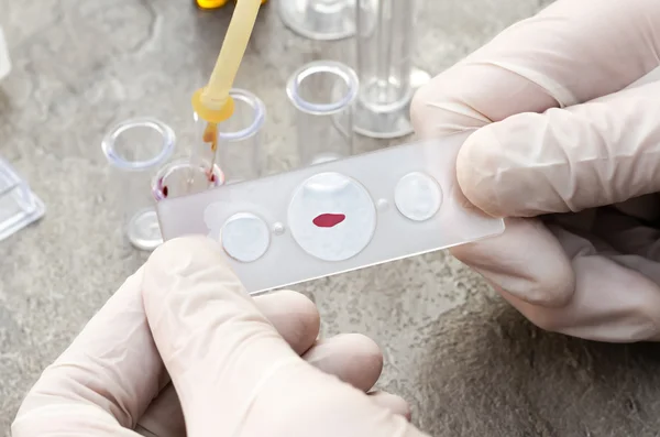 Badanie krwi i eksperymentalnych badań w laboratorium Obraz Stockowy