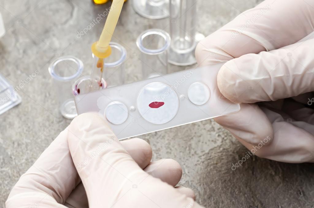 Blood test and experimental research in laboratory