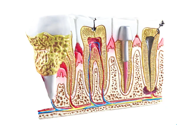 Dental section model, teeth anatomic background. — Stock Photo, Image