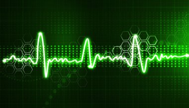 Elektrokardiyogram, EKG arka plan