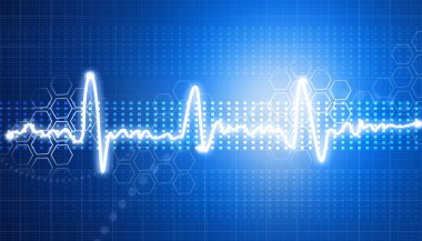 Elektrokardiyogram, EKG arka plan
