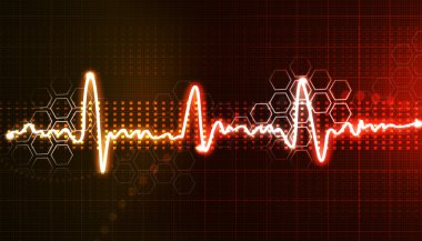 Elektrokardiyogram, EKG arka plan