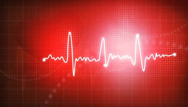 Electrocardiogram, ecg background — Stock Photo, Image