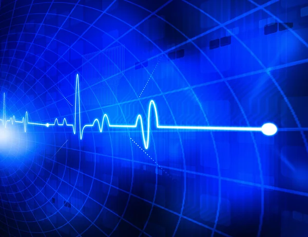 Electrocardiogram — Stock Photo, Image