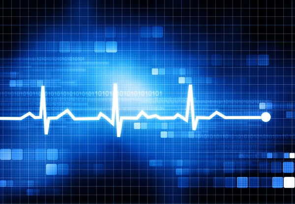 Electrocardiogram — Stock Photo, Image