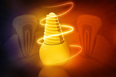 diş implantı