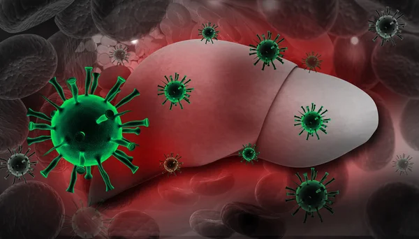 Liver Infection with hepatitis viruses — Stock Photo, Image