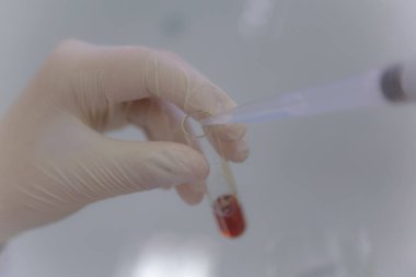 Laboratuvarda covid19 vacine test antivirüsü için test ekipmanları. Tüp, hasta Corona virüsü veya Covid-19 için yapılan test aşısı muayenesidir. Araştırma ekibi antivirüs aşısını analiz edip tanımlıyor..