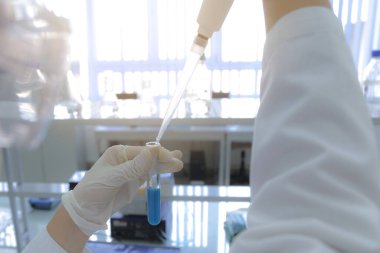 Laboratuvarda covid19 vacine test antivirüsü için test ekipmanları. Tüp, hasta Corona virüsü veya Covid-19 için yapılan test aşısı muayenesidir. Araştırma ekibi antivirüs aşısını analiz edip tanımlıyor..