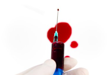 Laboratuvar ortamında şırınga