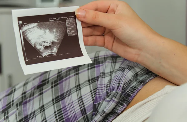 Pregnant woman enjoy looking at ultrasound scan of baby — Stock Photo, Image